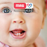 مراقبت از دندان کودکان را از بدو تولد آغاز کنید!