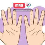 بیماری رینود یا بی حسی انگشتان دست چیست؟