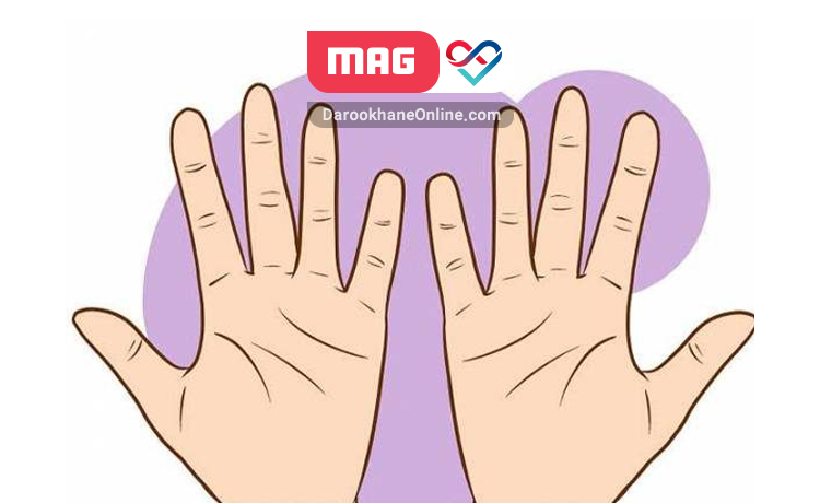 بیماری رینود یا بی حسی انگشتان دست چیست؟
