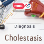cholestasis of pregnancy 1