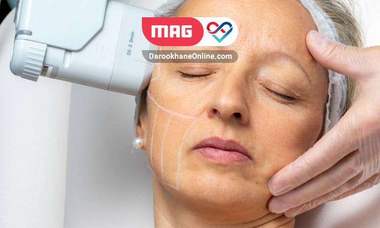 هایفوتراپی و مزایای آن برای پوست هایفوتراپی