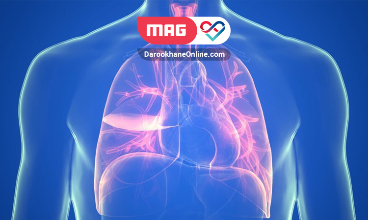pleural effusion 3