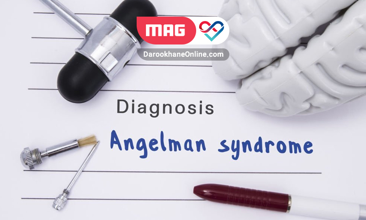 angelman syndrome 2