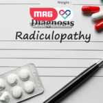 radiculopathy 1