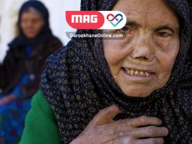 بیماری جذام