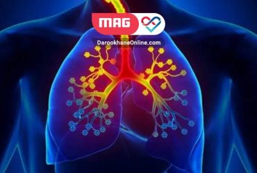 آسم ائوزینوفیلیک