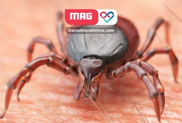 بیماری بابزیوز