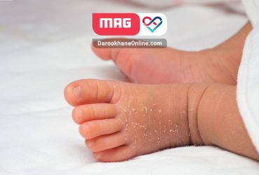 پوسته ریزی نوزاد چیست و چگونه بهبود می یابد پوسته ریزی