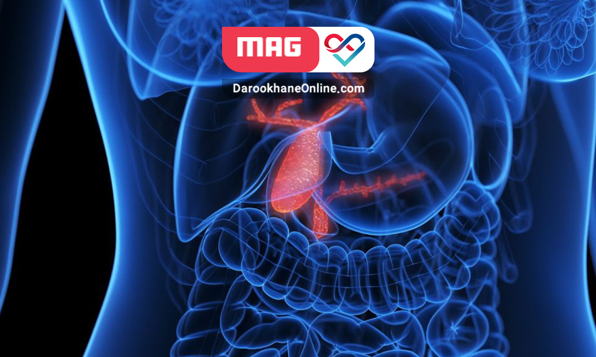 کله سیستیت یا التهاب حاد کیسه صفرا: علائم و درمان کله سیستیت