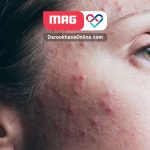 کرم کلیندامایسین