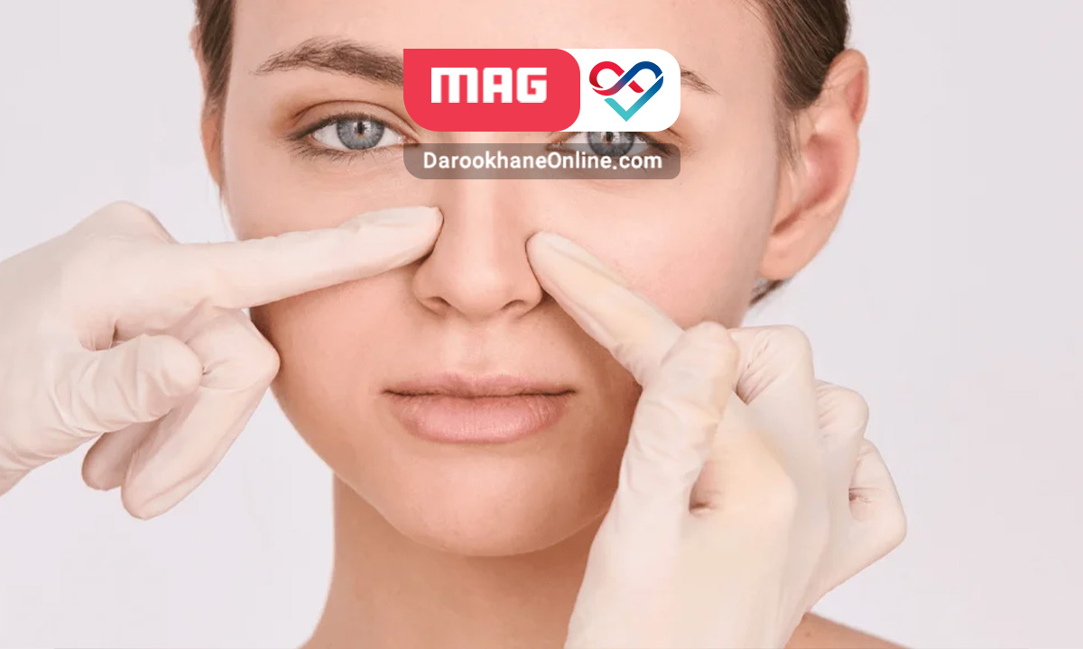 تزریق فیلر بینی: مزایا و عوارض آن فیلر بینی