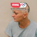 تصویر شاخص ریزش-موی-سکه-ای