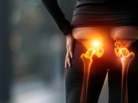 درمان شکستگی لگن و نکات مهم در بهبودی شکستگی لگن