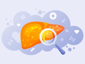 پیشگیری از بیماری های کبدی با سبک زندگی پیشگیری از بیماری های کبدی