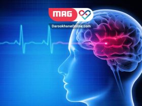 پیشگیری از سکته مغزی