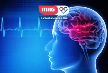 پیشگیری از سکته مغزی