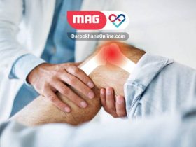 پیشگیری از آرتروز با ورزش پیشگیرانه پیشگیری از آرتروز