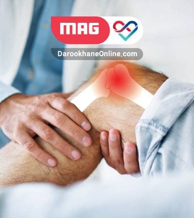 پیشگیری از آرتروز