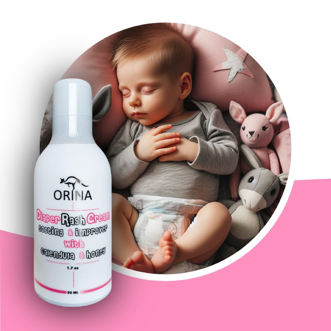 کرم سوختگی و اگزمای کودک اورینا 50 میل