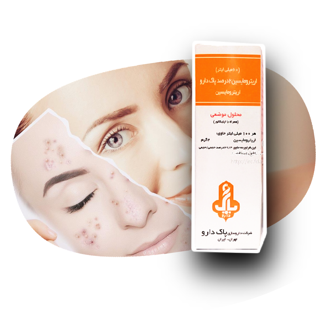 محلول موضعی اریترومایسین 2درصد پاک دارو 60میل